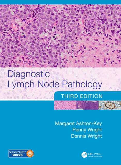 E-book Diagnostic Lymph Node Pathology Margaret Ashton-Key
