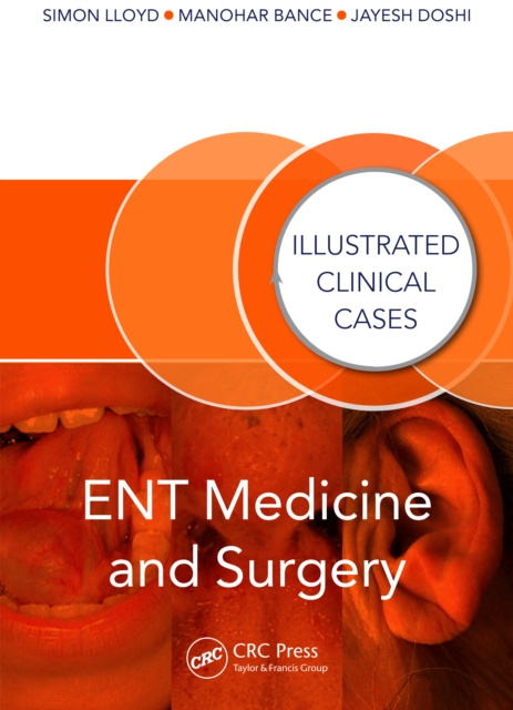 E-book ENT Medicine and Surgery Jayesh Doshi
