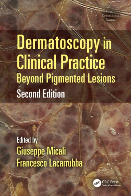 E-kniha Dermatoscopy in Clinical Practice Giuseppe Micali