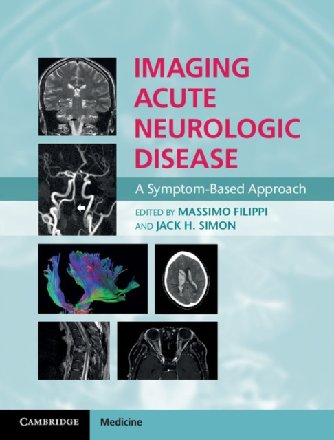 E-kniha Imaging Acute Neurologic Disease Massimo Filippi