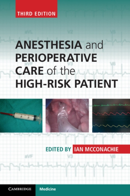 E-kniha Anesthesia and Perioperative Care of the High-Risk Patient Ian McConachie