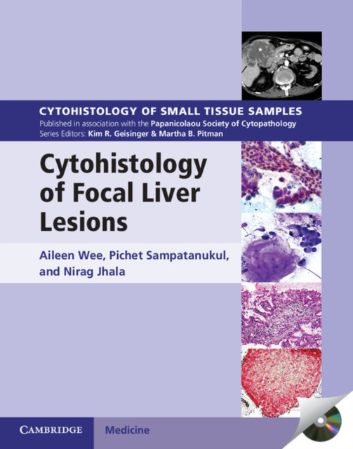 E-kniha Cytohistology of Focal Liver Lesions Aileen Wee