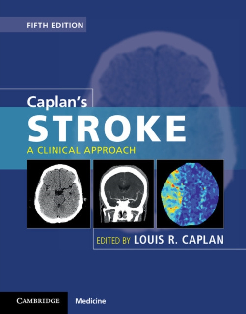 Libro electrónico Caplan's Stroke Louis R. Caplan