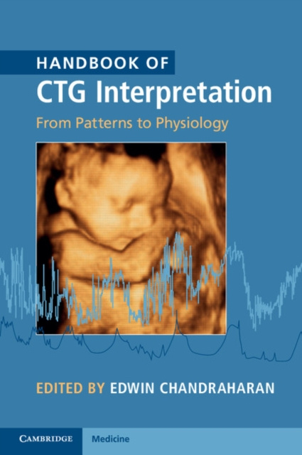 E-knjiga Handbook of CTG Interpretation Edwin Chandraharan