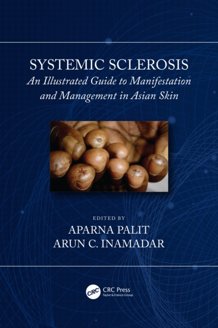 E-knjiga Systemic Sclerosis Arun C Inamadar