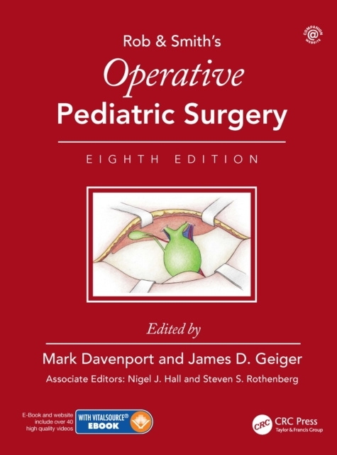 E-book Operative Pediatric Surgery Mark Davenport