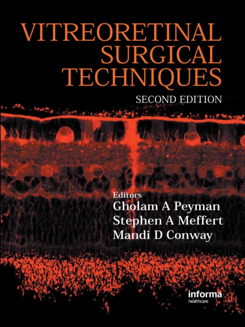 E-knjiga Vitreoretinal Surgical Techniques, Second Edition Gholam A. Peyman