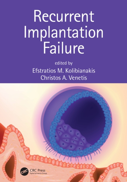 E-book Recurrent Implantation Failure Efstratios M. Kolibianakis