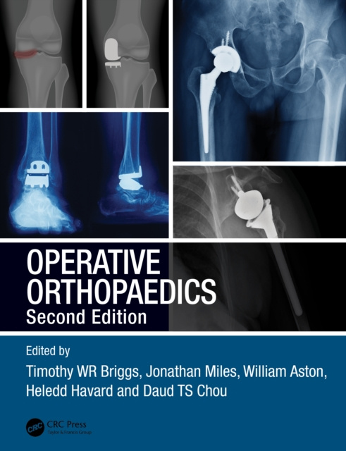 E-kniha Operative Orthopaedics Timothy WR Briggs