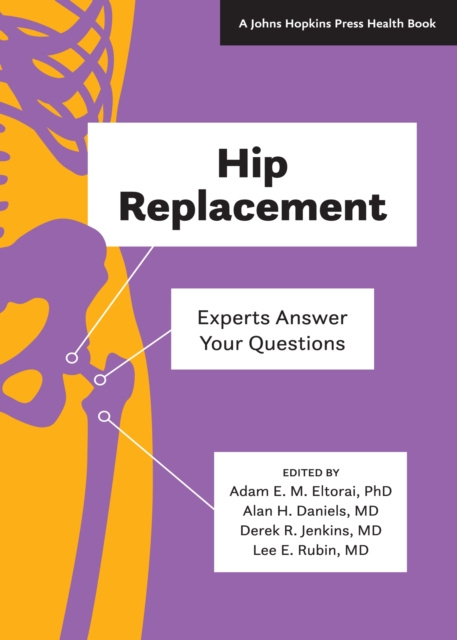 E-book Hip Replacement Adam E. M. Eltorai