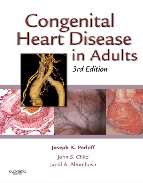 E-Book Congenital Heart Disease in Adults Joseph K. Perloff