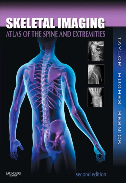 E-knjiga Skeletal Imaging John A. M. Taylor