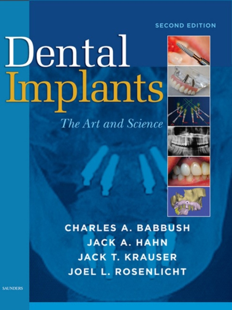 E-knjiga Dental Implants Charles A. Babbush