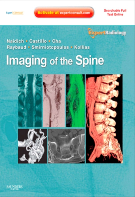 E-kniha Imaging of the Spine E-Book Thomas P. Naidich