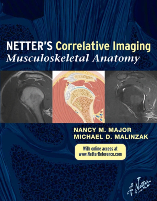 E-kniha Netter Correlative Imaging: Musculoskeletal Anatomy E-book Nancy M. Major