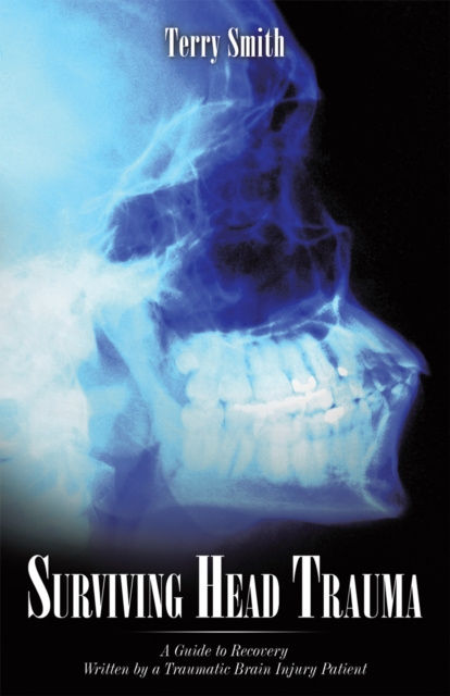 E-knjiga Surviving Head Trauma Terry Smith