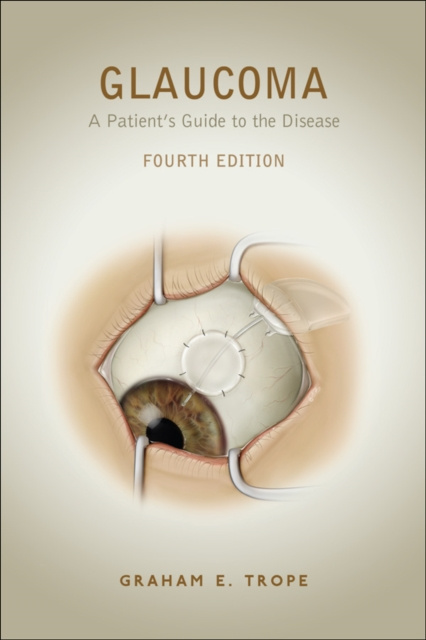 E-knjiga Glaucoma Graham E. Trope