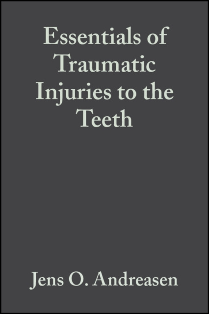 E-kniha Essentials of Traumatic Injuries to the Teeth Jens O. Andreasen
