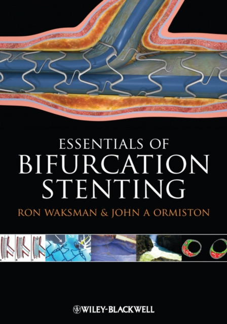 E-book Bifurcation Stenting Ron Waksman