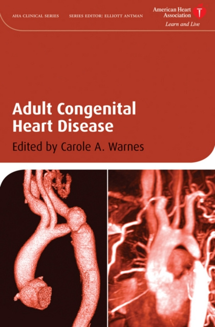 E-kniha Adult Congenital Heart Disease Carole A. Warnes