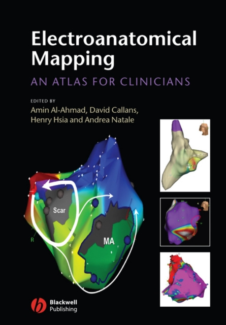 E-kniha Electroanatomical Mapping Amin Al-Ahmad
