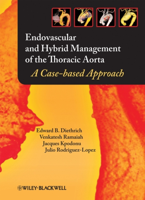 E-kniha Endovascular and Hybrid Management of the Thoracic Aorta Venkatesh Ramaiah