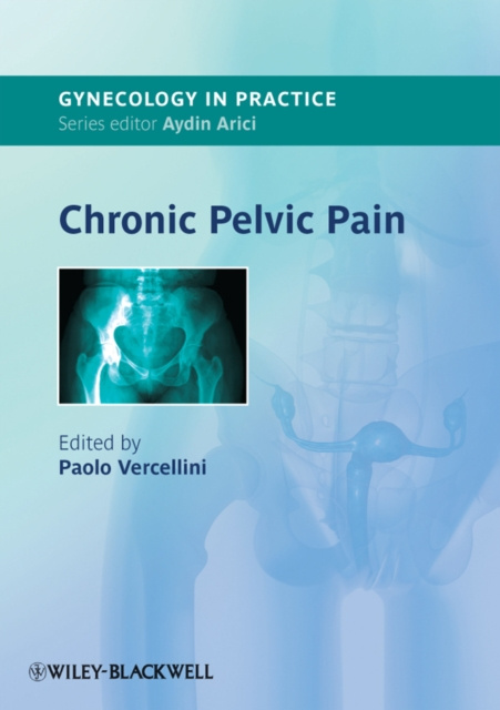 E-book Chronic Pelvic Pain Paolo Vercellini