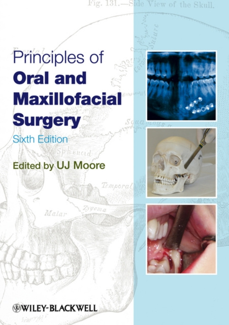 E-kniha Principles of Oral and Maxillofacial Surgery U. J. Moore