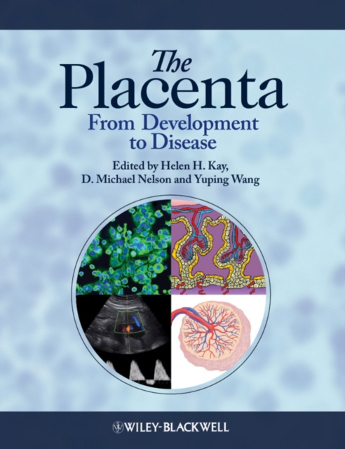 E-book Placenta D. Michael Nelson