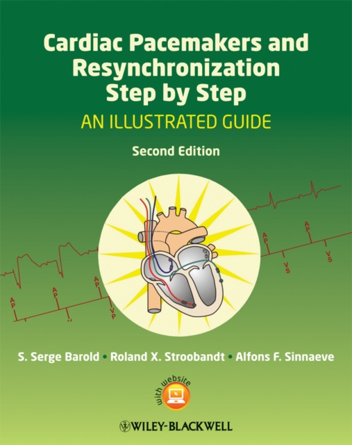 E-book Cardiac Pacemakers and Resynchronization Step by Step S. Serge Barold