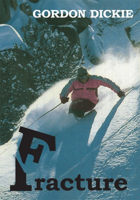 E-book Fracture Gordon Dickie