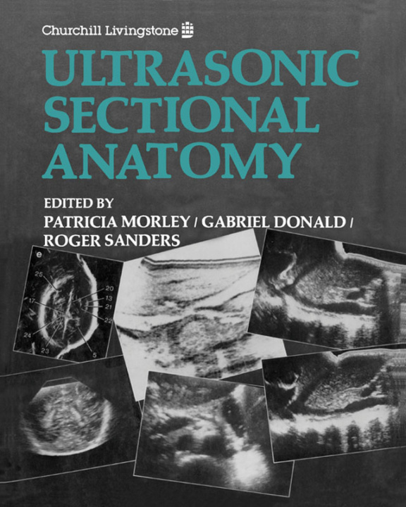 E-Book Ultrasonic Sectional Anatomy Patricia Morley