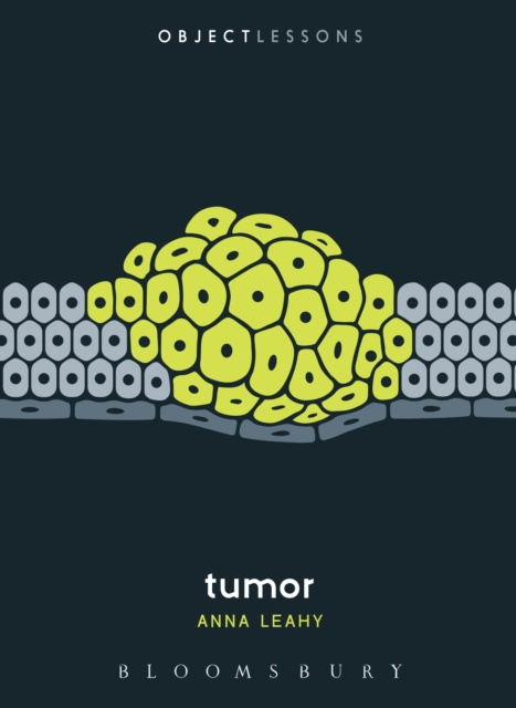 E-knjiga Tumor Leahy Anna Leahy
