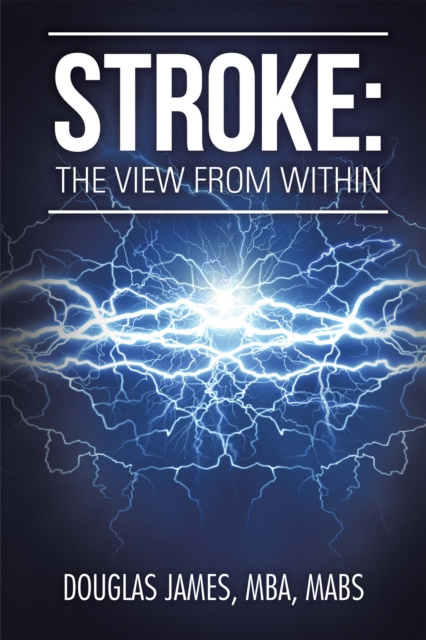 E-knjiga Stroke Douglas James MBA MABS