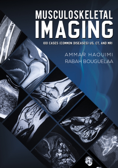 E-kniha Musculoskeletal Imaging Ammar Haouimi