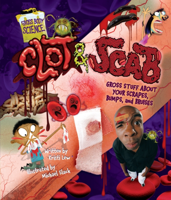E-book Clot & Scab Kristi Lew