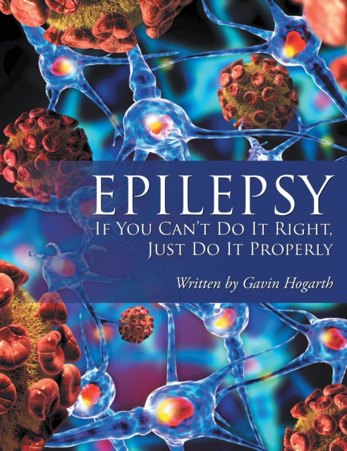 E-book Epilepsy Gavin Hogarth