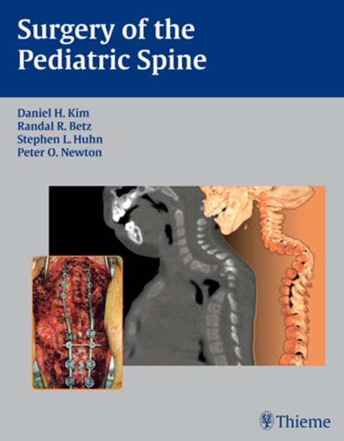 E-kniha Surgery of the Pediatric Spine Daniel H. Kim
