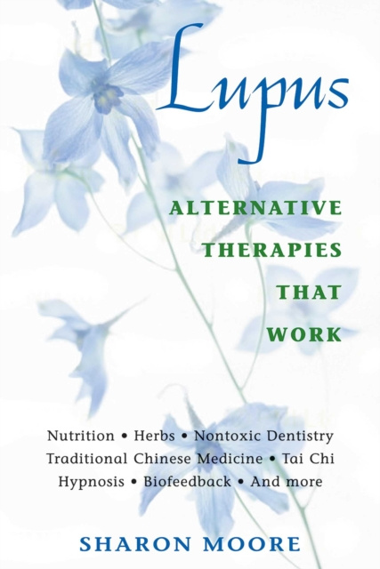 E-Book Lupus Sharon Moore