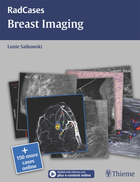 E-kniha Breast Imaging Lonie L. Salkowski