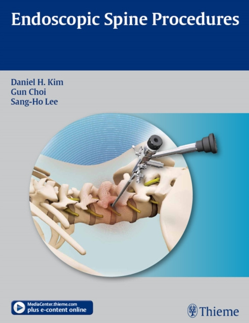 E-book Endoscopic Spine Procedures Daniel H. Kim