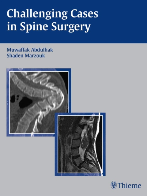 E-kniha Challenging Cases in Spine Surgery Muwaffak Abdulhak