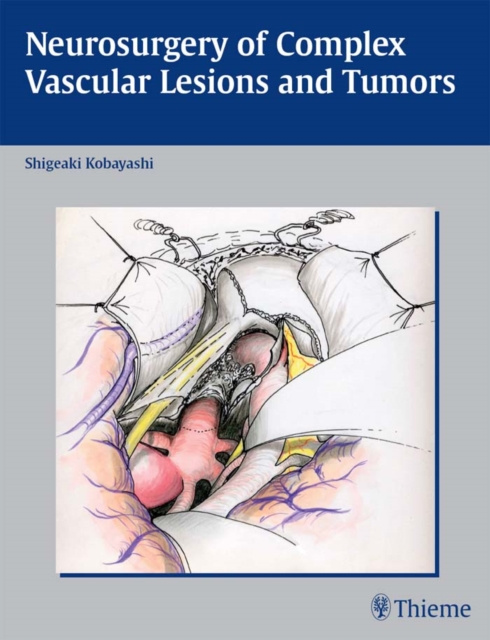 E-kniha Neurosurgery of Complex Vascular Lesions and Tumors S. Kobayashi