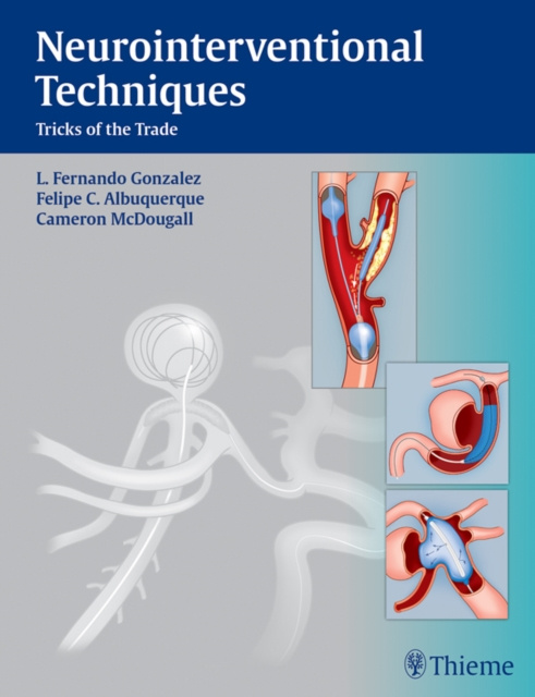 E-kniha Neurointerventional Techniques L. Fernando Gonzalez
