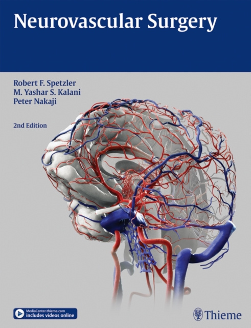 E-kniha Neurovascular Surgery Robert F. Spetzler