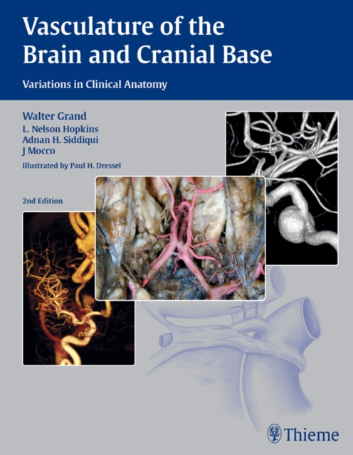 E-kniha Vasculature of the Brain and Cranial Base Walter Grand