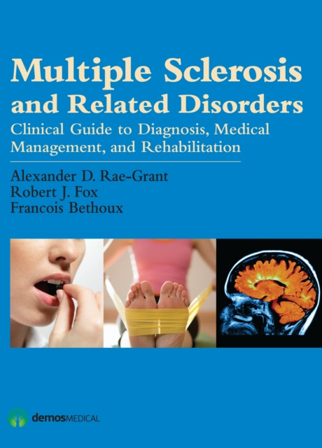E-knjiga Multiple Sclerosis and Related Disorders MD Alexander D. Rae-Grant