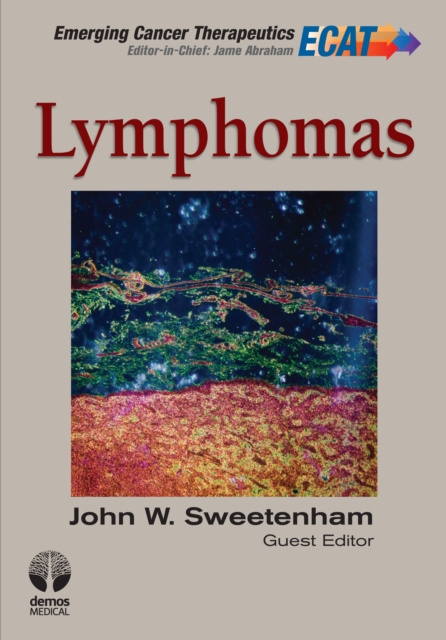 E-knjiga Lymphomas MD John W. Sweetenham