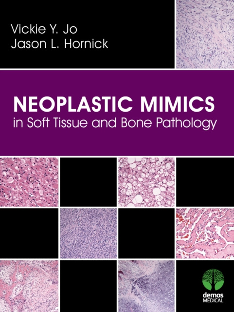 E-kniha Neoplastic Mimics in Soft Tissue and Bone Pathology MD Vickie Y. Jo