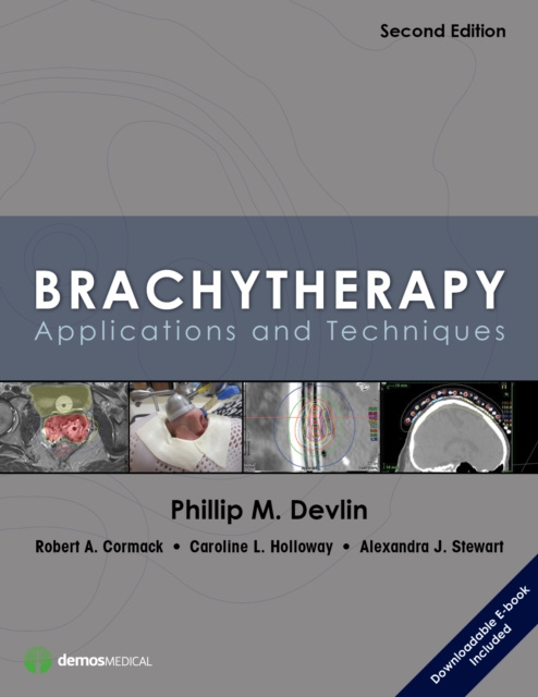 E-knjiga Brachytherapy Phillip M. Devlin MD FACR